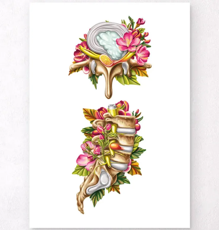 Bandscheibenvorfall - Floral - Weiß | Codex Anatomicus Hot