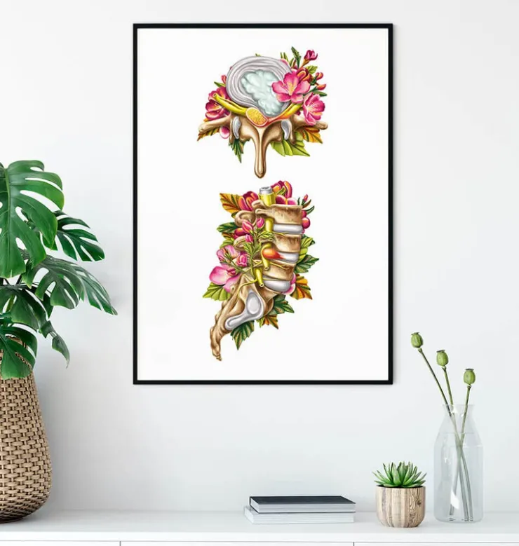 Bandscheibenvorfall - Floral - Weiß | Codex Anatomicus Hot