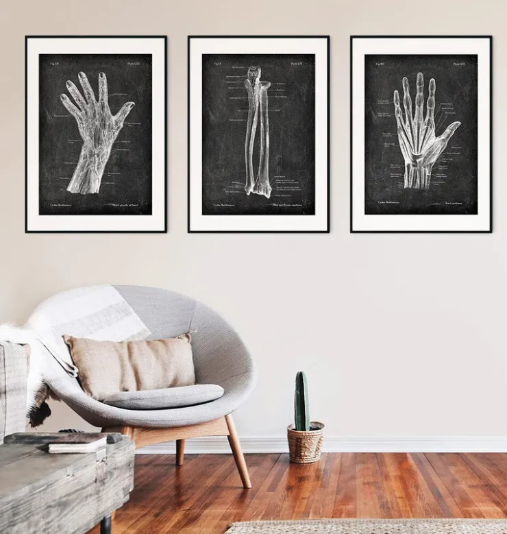 Blutgefäße der Hand - Chalkboard | Codex Anatomicus Outlet