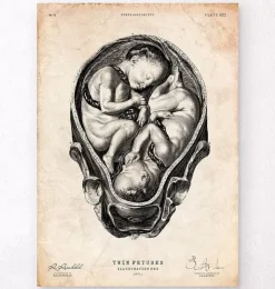 Fötus im Mutterleib II | Codex Anatomicus Sale