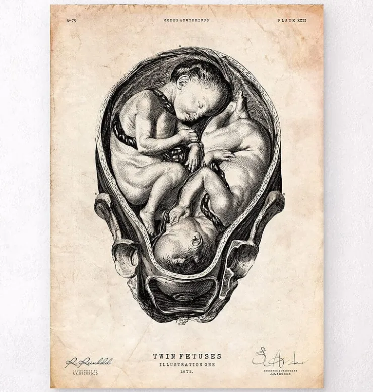 Fötus im Mutterleib II | Codex Anatomicus Sale