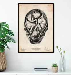 Fötus im Mutterleib II | Codex Anatomicus Sale