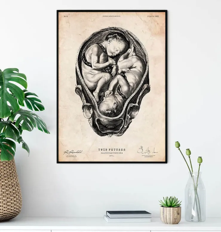 Fötus im Mutterleib II | Codex Anatomicus Sale