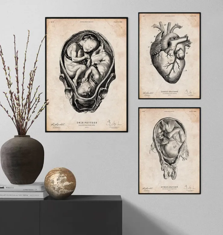 Fötus im Mutterleib II | Codex Anatomicus Sale