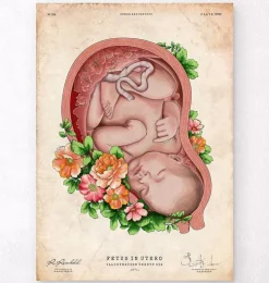 Fötus im Mutterleib II - Floral - Altes Papier | Codex Anatomicus Fashion