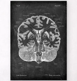 Gehirn im Schnitt - Chalkboard | Codex Anatomicus Fashion