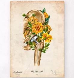 Hüftprothese - Floral - Vintage | Codex Anatomicus Clearance