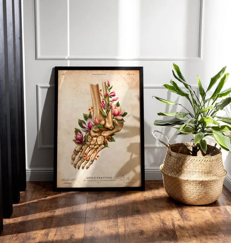 Knöchelbruch - Floral - Vintage | Codex Anatomicus Clearance