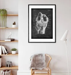 Knie Anatomie - Chalkboard | Codex Anatomicus Hot