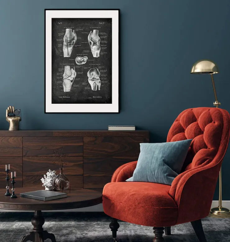 Knie Anatomie II - Chalkboard | Codex Anatomicus Clearance