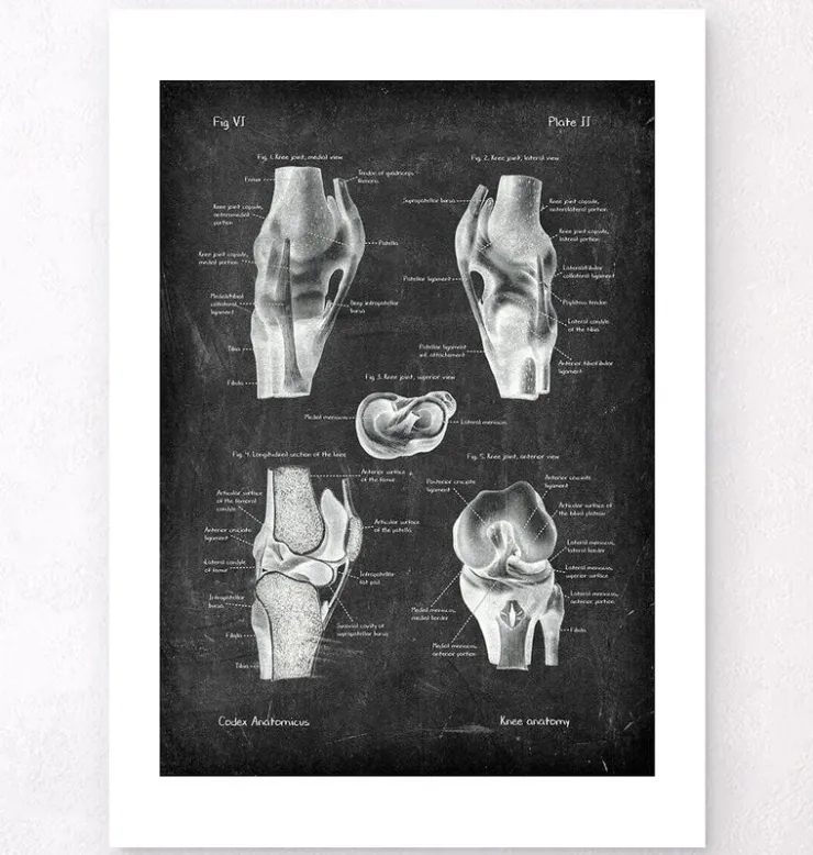 Knie Anatomie II - Chalkboard | Codex Anatomicus Clearance