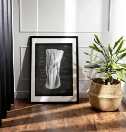 Kniekehle Anatomie - Chalkboard | Codex Anatomicus Online