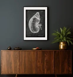 Niere und Nebenniere - Chalkboard | Codex Anatomicus Hot