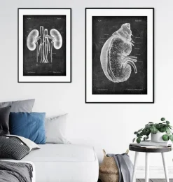 Niere und Nebenniere - Chalkboard | Codex Anatomicus Hot